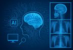 Artificial intelligence analyzing radiology scans for medical diagnostics and advancements